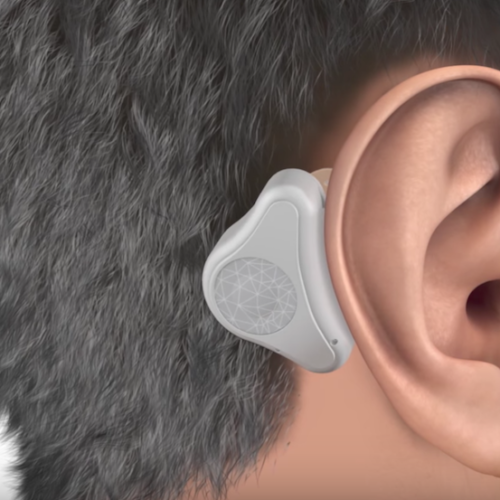 Dr. Ranjit Bhosle - Best Plastic Surgeon | Gynecomastia | Cyst Removal | Lipoma | Breast Surgery | Liposuction Expert.Dr. Ranjit Bhosale - Best Plastic Surgeon | Gynecomastia | Liposuction Expert| Cyst Removal Lipoma | Hair, Transplant. Ghatkopar West, , Borivali East, Mumbai, Maharashtra,Maroshi Rd Andheri.