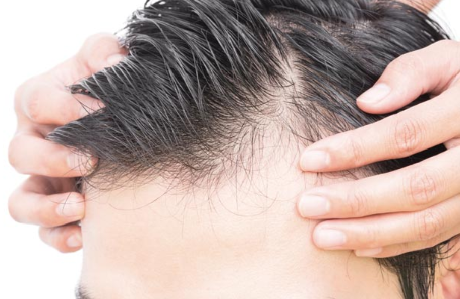 Dr. Ranjit Bhosle - Best Plastic Surgeon | Gynecomastia | Cyst Removal | Lipoma | Breast Surgery | Liposuction Expert.Dr. Ranjit Bhosale - Best Plastic Surgeon | Gynecomastia | Liposuction Expert| Cyst Removal Lipoma | Hair, Transplant. Ghatkopar West, , Borivali East, Mumbai, Maharashtra,Maroshi Rd Andheri.