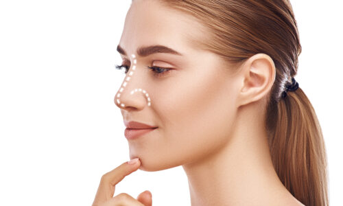 Smal nose correction Dr. Ranjit Bhosle - Best Plastic Surgeon | Gynecomastia | Cyst Removal | Lipoma | Breast Surgery | Liposuction Expert.Dr. Ranjit Bhosale - Best Plastic Surgeon | Gynecomastia | Liposuction Expert| Cyst Removal Lipoma | Hair, Transplant. Ghatkopar West, , Borivali East, Mumbai, Maharashtra,Maroshi Rd Andheri.