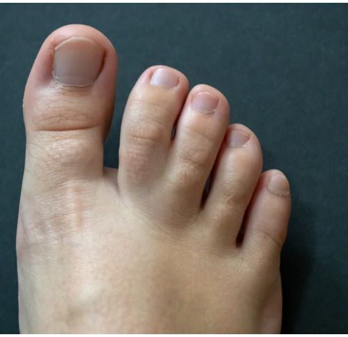 Dr. Ranjit Bhosle - Best Plastic Surgeon | Gynecomastia | Cyst Removal | Lipoma | Breast Surgery | Liposuction Expert.Dr. Ranjit Bhosale - Best Plastic Surgeon | Gynecomastia | Liposuction Expert| Cyst Removal Lipoma | Hair, Transplant. Ghatkopar West, , Borivali East, Mumbai, Maharashtra,Maroshi Rd Andheri.