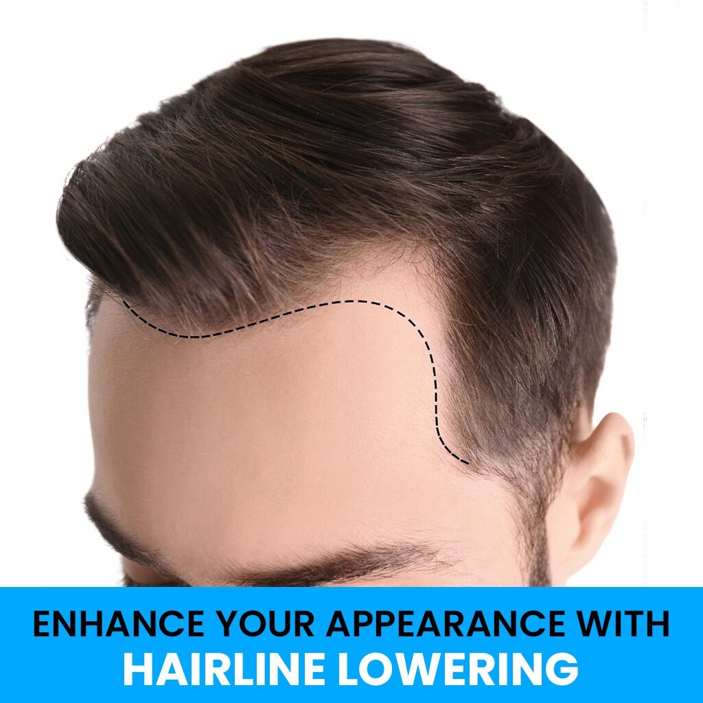 Dr. Ranjit Bhosle - Best Plastic Surgeon | Gynecomastia | Cyst Removal | Lipoma | Breast Surgery | Liposuction Expert.Dr. Ranjit Bhosale - Best Plastic Surgeon | Gynecomastia | Liposuction Expert| Cyst Removal Lipoma | Hair, Transplant. Ghatkopar West, , Borivali East, Mumbai, Maharashtra,Maroshi Rd Andheri.