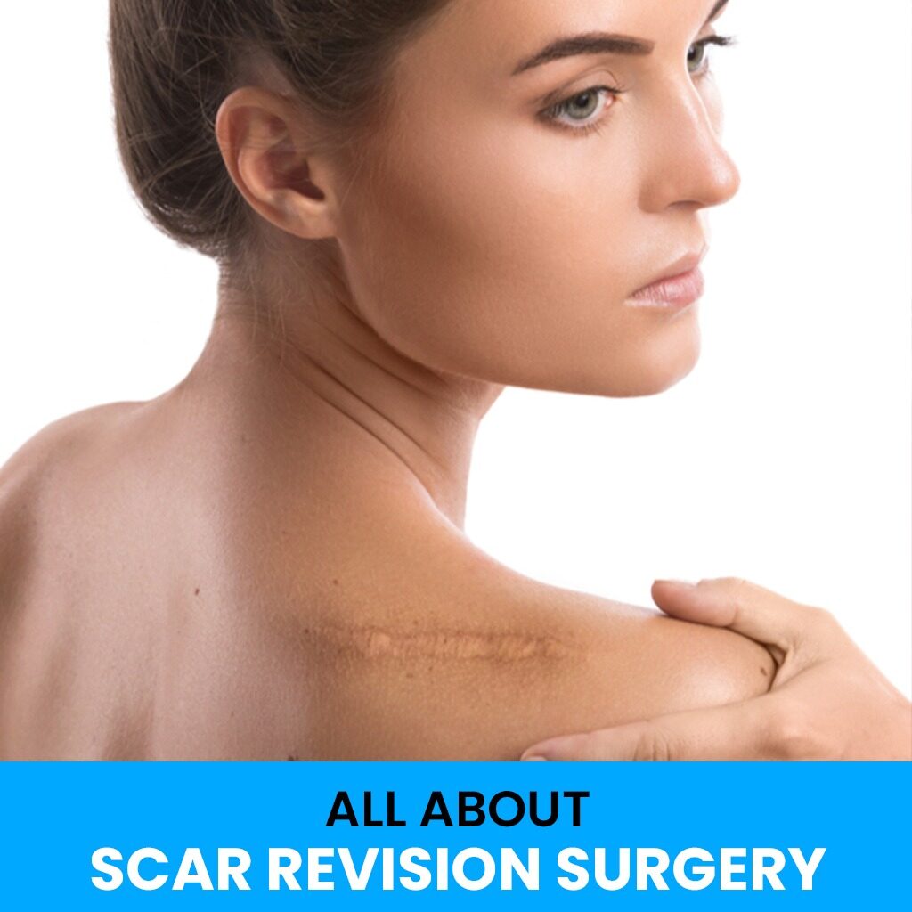 Dr. Ranjit Bhosle - Best Plastic Surgeon | Gynecomastia | Cyst Removal | Lipoma | Breast Surgery | Liposuction Expert.Dr. Ranjit Bhosale - Best Plastic Surgeon | Gynecomastia | Liposuction Expert| Cyst Removal Lipoma | Hair, Transplant. Ghatkopar West, , Borivali East, Mumbai, Maharashtra,Maroshi Rd Andheri.